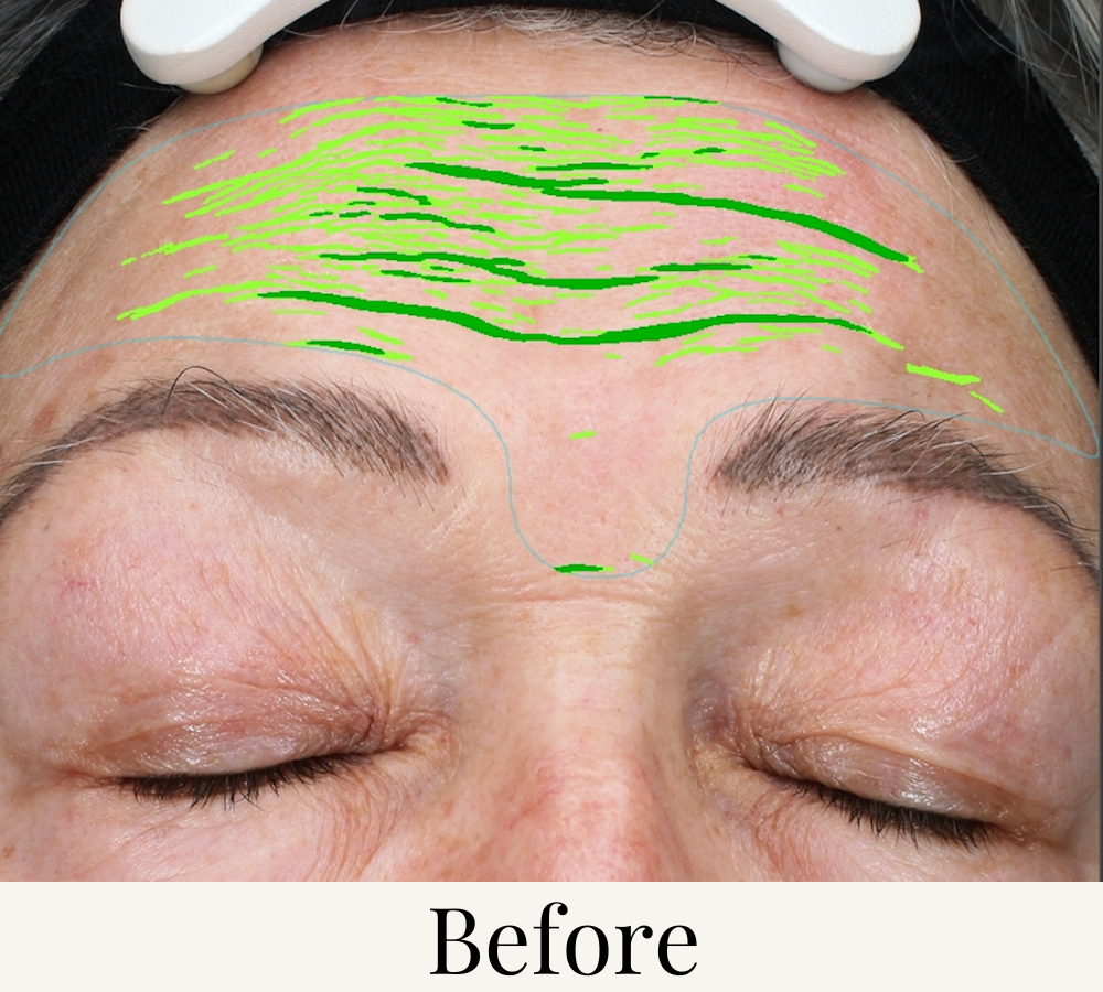 before after skin test