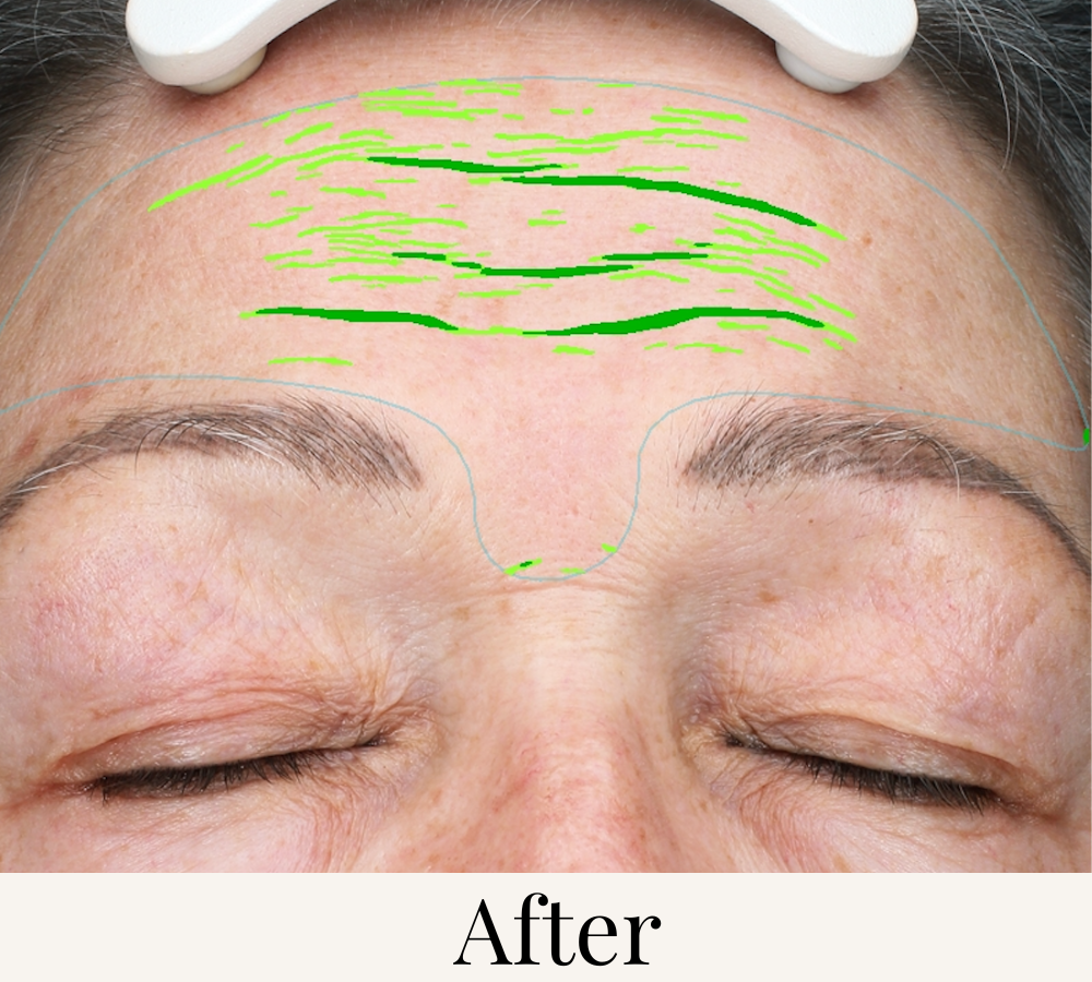 before after skin test